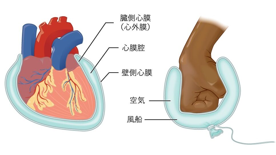 心膜の模式図。拳を心臓、風船の内側を臓側心膜、外側を壁側心膜とし、心膜腔のイメージを示した解剖イラスト。