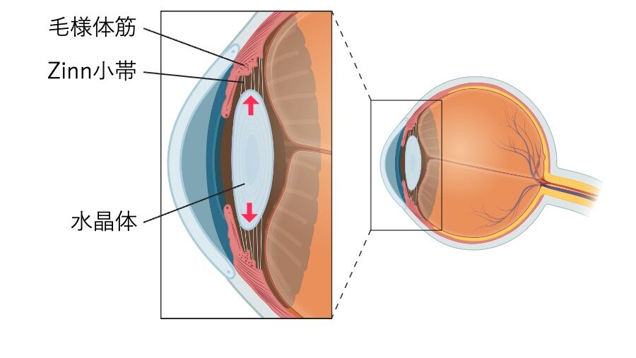遠方視時の毛様体筋と水晶体の模式図。毛様体筋の弛緩によりZinn小帯が緊張し、水晶体が薄く平坦になる様子を示している。