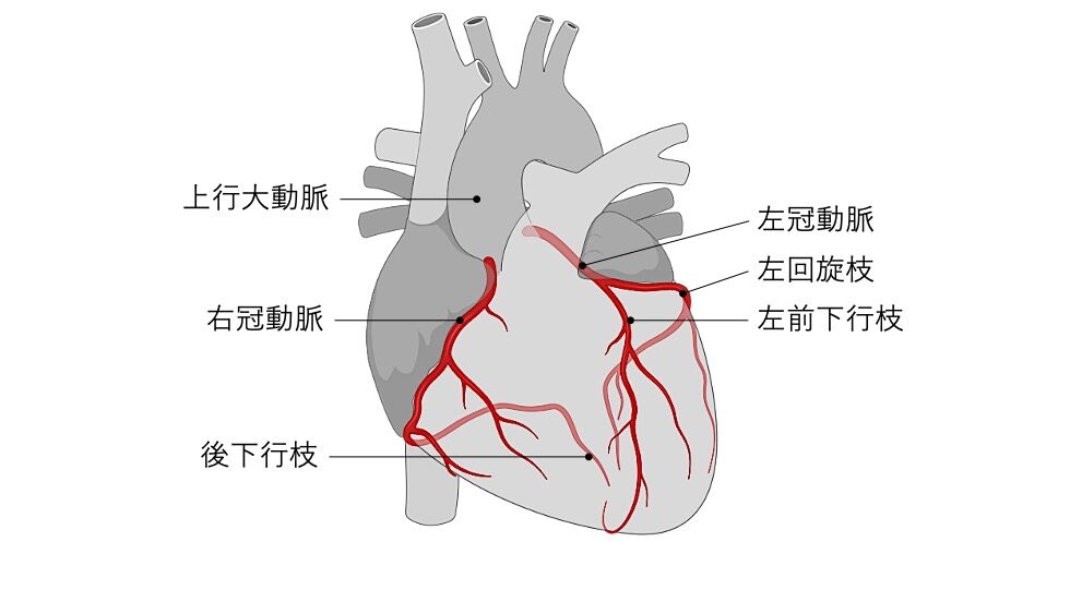 冠状動脈の図。右冠動脈、左冠動脈から分岐する左前下行枝、回旋枝、右冠動脈からの後下行枝を示した心臓冠動脈解剖図。