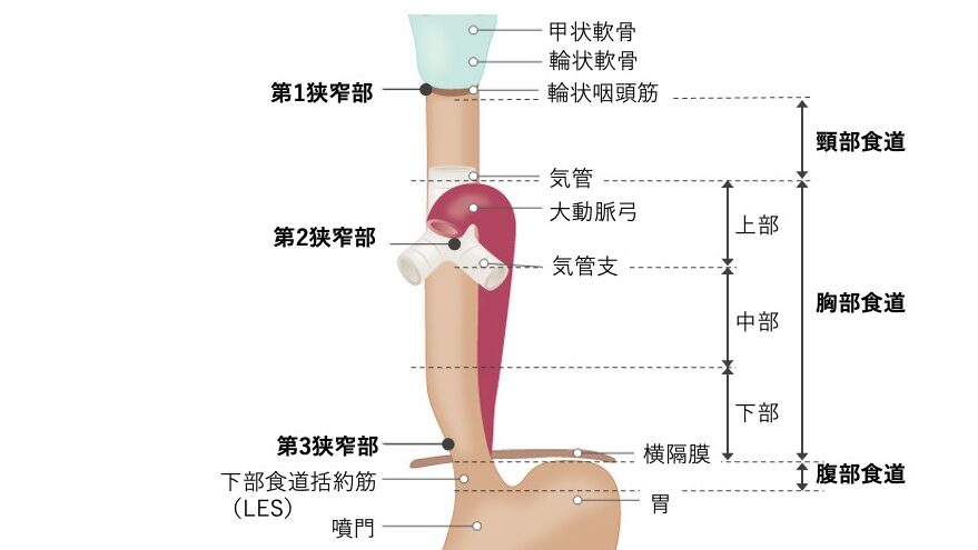 食道の模式図。頸部・胸部・腹部に区分され、第1狭窄部（食道入口部）、第2狭窄部（気管分岐部・大動脈弓部）、第3狭窄部（横隔膜通過部）が示されている。