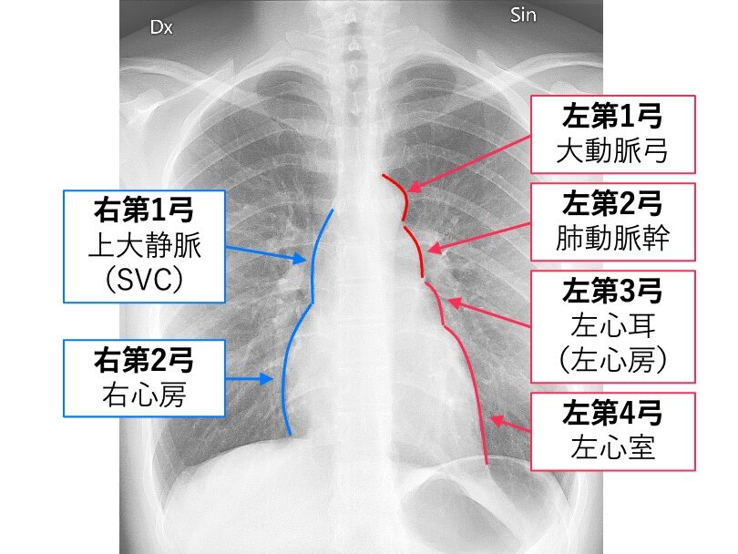 胸部X線画像に、心陰影の右第1弓〜左第4弓の部位を示した図。