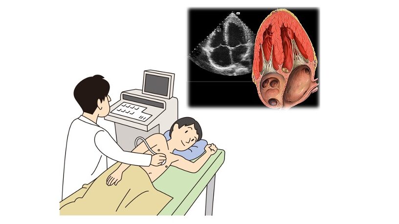 胸壁にプローブを当てて心臓を観察する心エコー検査のイラスト。