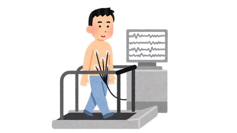 胸に電極をつけた男性がトレッドミル上で歩行しながら心電図を測定しているイラスト。