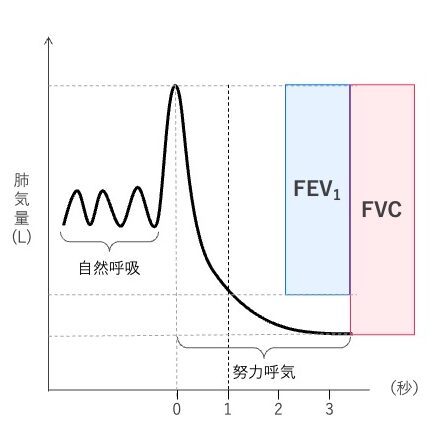 最大吸気後に行う努力呼気の呼吸曲線を示した図。左に自然呼吸、右に努力呼気の曲線を示し、努力呼気全体の量が努力肺活量（FVC）、開始から最初の1秒間に吐き出された量が1秒量（FEV₁）として色分けされている。