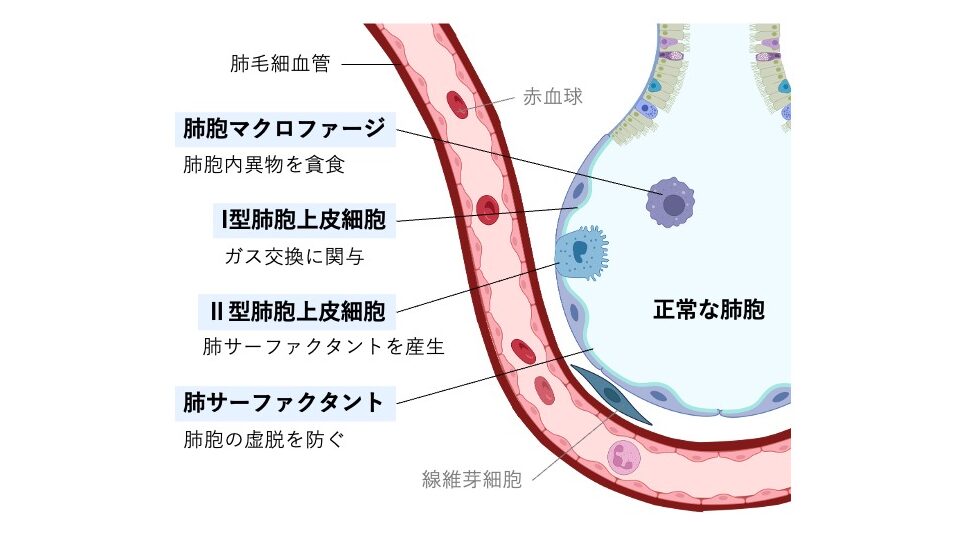 正常な肺胞の模式図。Ⅰ型肺胞上皮細胞によるガス交換、Ⅱ型肺胞上皮細胞による肺サーファクタント産生、肺胞マクロファージによる異物貪食の様子と、肺毛細血管との位置関係を示している。