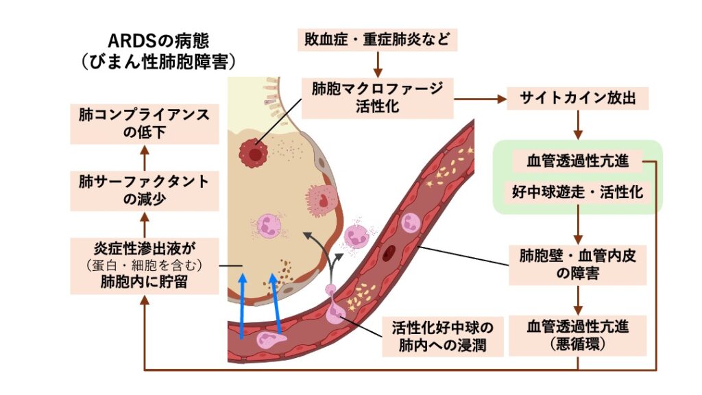 ARDSの模式図。炎症により肺胞マクロファージと好中球が活性化し、血管透過性亢進と炎症性滲出液の肺胞内貯留、肺胞壁障害、肺サーファクタント減少が生じる過程を示す。